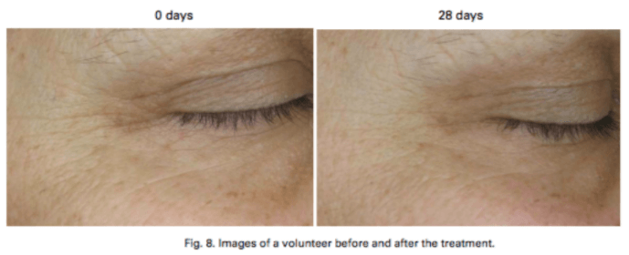 Infinity Capsules - ONSEN SECRET