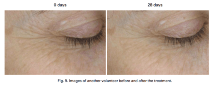 Infinity Capsules - ONSEN SECRET